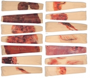 TEE-UU Trauma-Simulation RAPID